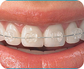 dental clinic in ahmedabad
