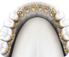 orthodontics in ahmedabad