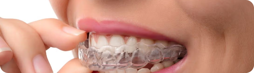 braces treatment doctor in ahmedabad