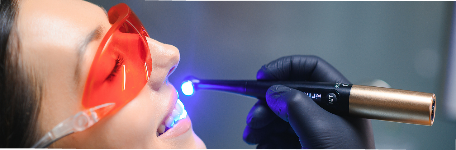 Laser Dentistry in Ahmedabad